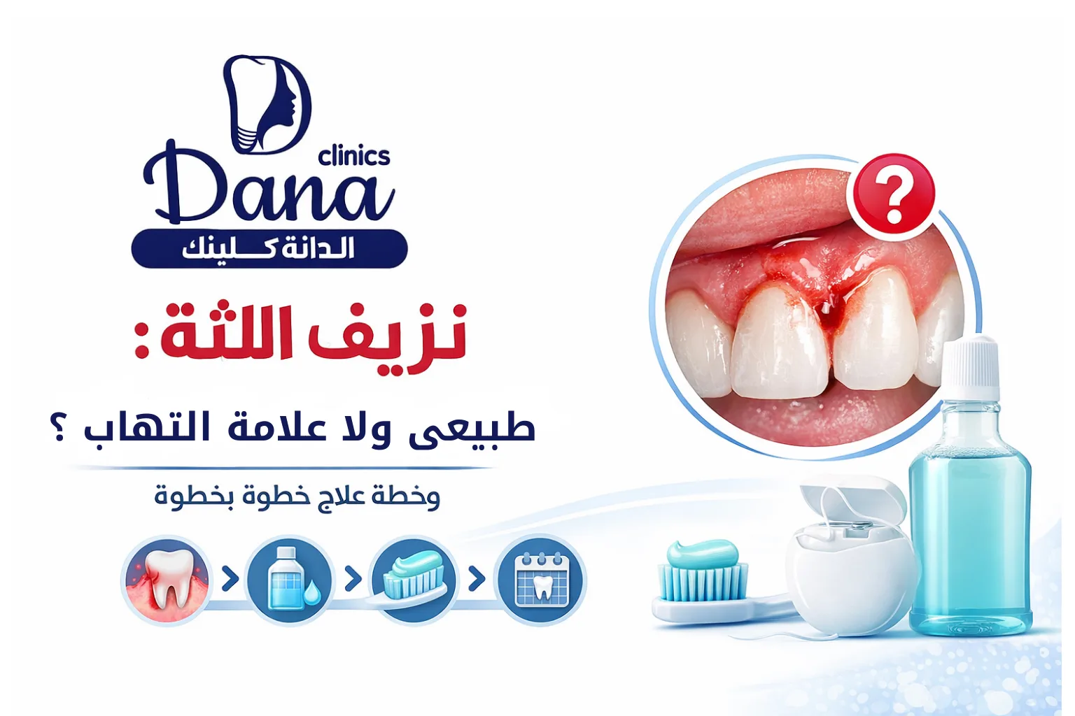 نزيف اللثة: طبيعي ولا علامة التهاب؟ وخطة علاج خطوة بخطوة