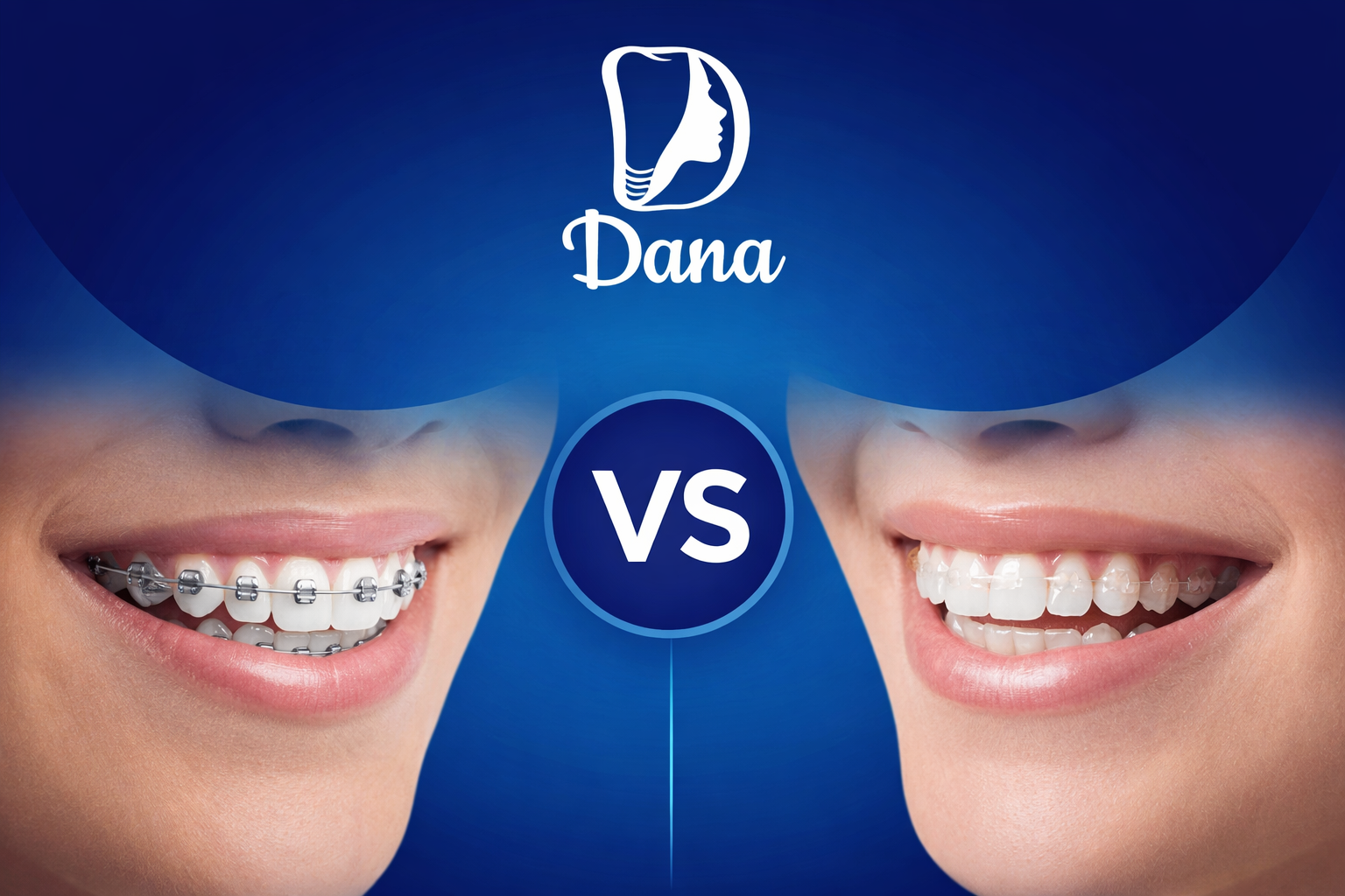 تقويم الأسنان: معدني vs شفاف… مين الأنسب لحالتك؟